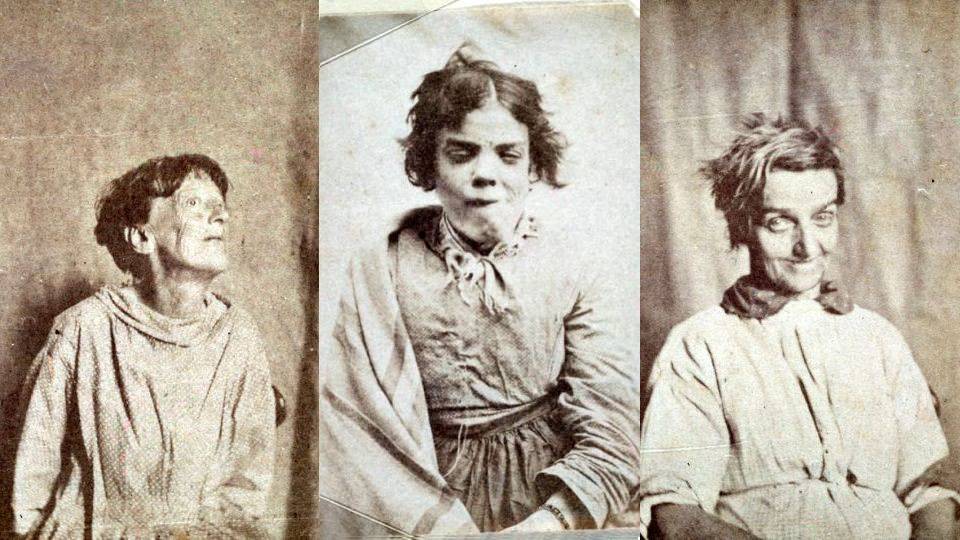 Az elmebetegek arckifejezésében kereste az őrületet a 19. századi brit tudós
