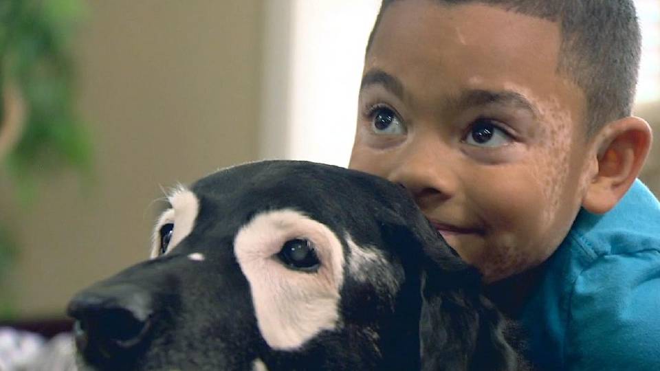 Egy kutya miatt fogadta el önmagát és betegségét egy kisfiú